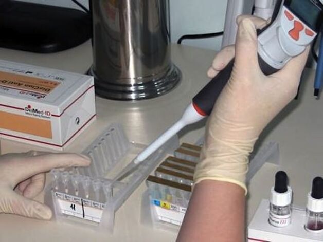 Laboratórne testy na diagnostiku parazitárnych ochorení